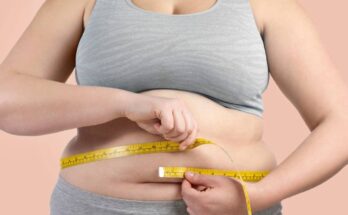 elhízás és egészségügyi hatásai